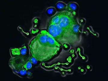 Científicos del CNIO descubren un nuevo mecanismo para la formación de plaquetas de sangre Científicos del CNIO descubren un nuevo mecanismo para la formación de plaquetas de sangre