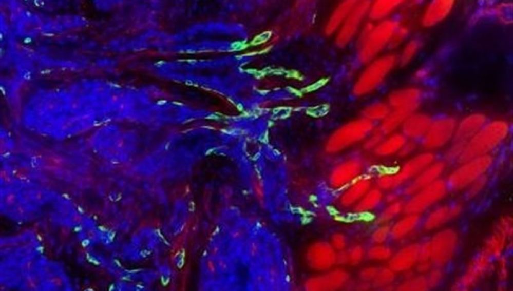 Una investigación presenta un atlas que detalla las proteínas vinculadas al cáncer 