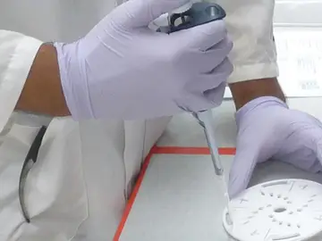 Crean un dispositivo que cuesta menos de 10 euros y detecta el cáncer en 10 minutos Crean un dispositivo que cuesta menos de 10 euros y detecta el cáncer en 10 minutos
