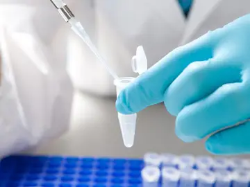 La biopsia líquida una nueva técnica para analizar la evolución del cáncer La biopsia líquida una nueva técnica para analizar la evolución del cáncer
