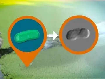 Investigadores capturan las primeras imágenes de bacterias vivas en rayos X Investigadores capturan las primeras imágenes de bacterias vivas en rayos X