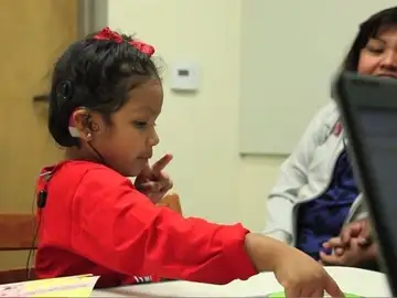 Un nuevo implante permite que niños sin el nervio auditivo puedan oír Un nuevo implante permite que niños sin el nervio auditivo puedan oír
