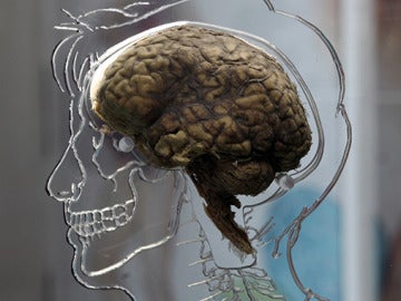 ¿Por qué nuestro cerebro es tan grande?