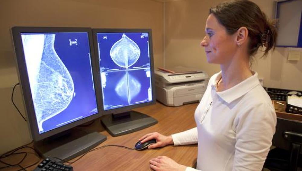 Con esta técnica, las mamografías reducirían su impacto sobre la paciente
