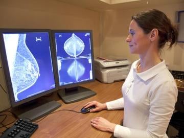Con esta técnica, las mamografías reducirían su impacto sobre la paciente
