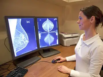 Con esta técnica, las mamografías reducirían su impacto sobre la paciente Con esta técnica, las mamografías reducirían su impacto sobre la paciente