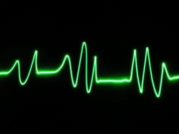 Un nuevo sistema podría controlar la actividad eléctrica del corazón a tiempo real Un nuevo sistema podría controlar la actividad eléctrica del corazón a tiempo real