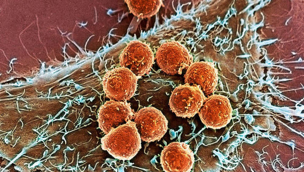 Nuevos tratamientos podrían mejorar la inmunoterapia del cáncer