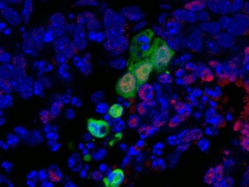 Un nuevo tipo de células madre que permitirá desarrollar órganos de reemplazo