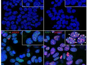 Científicos del CNIO descubren una estrategia para combatir el cáncer Científicos del CNIO descubren una estrategia para combatir el cáncer