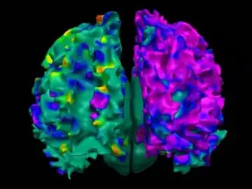 Proteína clave en las enfermedades neurodegenerativas Proteína clave en las enfermedades neurodegenerativas