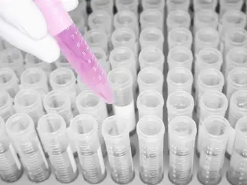 Desarrollan un test epigenético para diagnosticar el cáncer de origen desconocido Desarrollan un test epigenético para diagnosticar el cáncer de origen desconocido