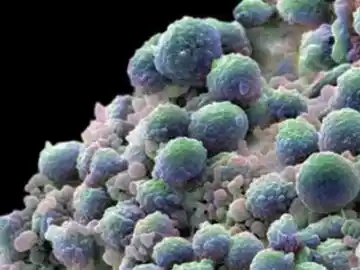 Biopsia líquida Biopsia líquida