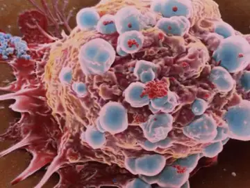 Descubren una mutación genética que permitiría diseñar nuevas terapias contra el cáncer Descubren una mutación genética que permitiría diseñar nuevas terapias contra el cáncer