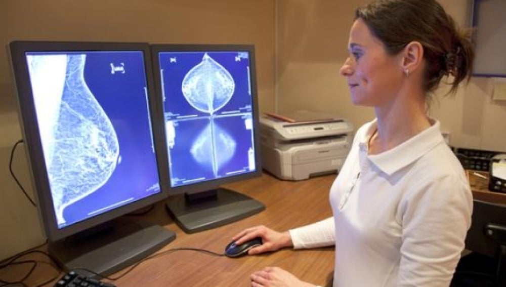 Una mujer revista una mamografía