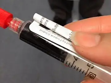Un líquido inyectable para iluminar el cáncer Un líquido inyectable para iluminar el cáncer