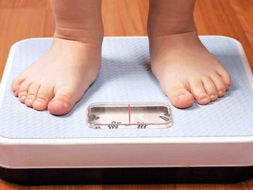 Sobrepeso en niños
