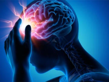 La epilepsia, una enfermedad que puede controlarse gracias a los fármacos 