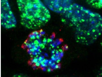 El CNIO descubre un mecanismo de resistencia a la quimioterapia 