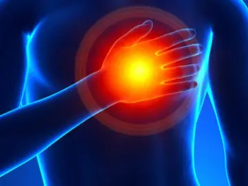 Pericarditis, una inflamación del corazón Pericarditis, una inflamación del corazón