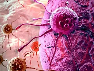 Investigadores del CNIO hallan el mecanismo que permite al cáncer sobrevivir sin glucosa Investigadores del CNIO hallan el mecanismo que permite al cáncer sobrevivir sin glucosa