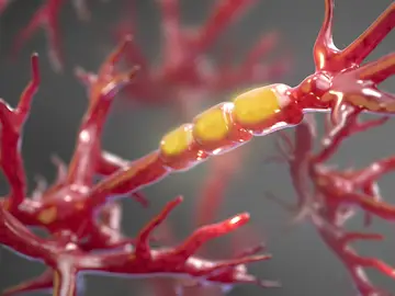Identifican el impulsor clave del daño de las células nerviosas de la ELA Identifican el impulsor clave del daño de las células nerviosas de la ELA
