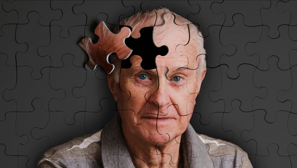 Diez claves para detectar el Alzheimer 