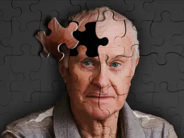 Diez claves para detectar el Alzheimer Diez claves para detectar el Alzheimer