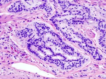 Científicos españoles ensayarán en 2017 un anticuerpo humanizado contra varios tumores cancerígenos Científicos españoles ensayarán en 2017 un anticuerpo humanizado contra varios tumores cancerígenos