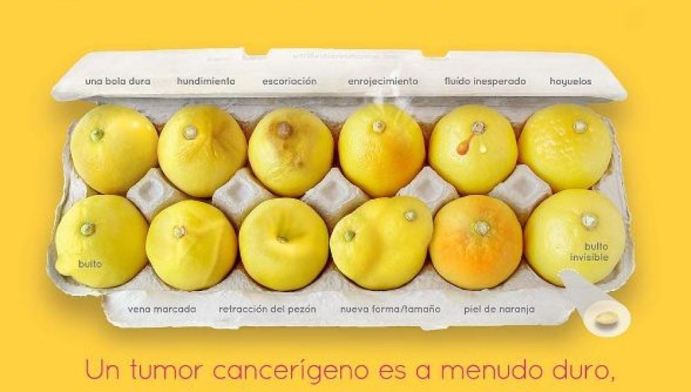 #KnowYourLemons: Una imagen con doce limones para aprender a detectar el cáncer de mama