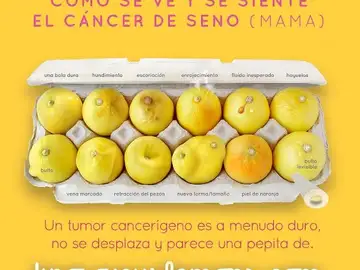 #KnowYourLemons: Una imagen con doce limones para aprender a detectar el cáncer de mama #KnowYourLemons: Una imagen con doce limones para aprender a detectar el cáncer de mama