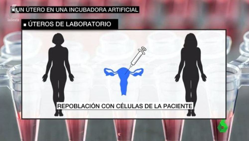 Úteros de laboratorio, una técnica pionera para mujeres que no pueden quedarse embarazadas 