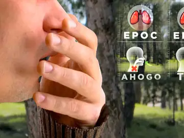 síntomas de la EPOC síntomas de la EPOC