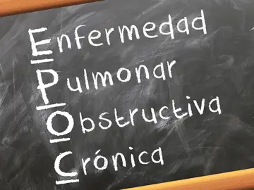 ¿Qué es la EPOC? ¿Qué es la EPOC?