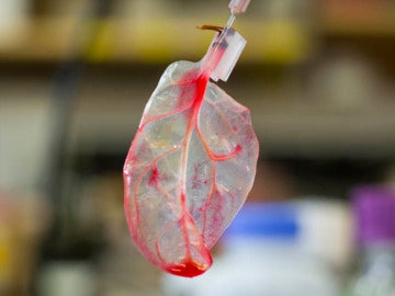 Investigadores consiguen cultivar tejido cardiaco humano en hojas de espinaca