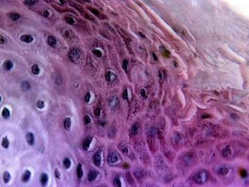 La varicela puede ser mortal por una mutación en el sistema inmunológico