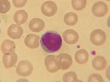 Crean un nuevo método para proteger al cuerpo de enfermedades autoinmunes Crean un nuevo método para proteger al cuerpo de enfermedades autoinmunes
