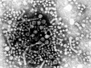 Hepatitis A Hepatitis A