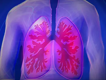 En 2030 la EPOC será la tercera causa de muerte En 2030 la EPOC será la tercera causa de muerte