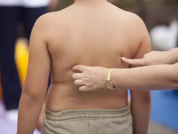 Investigación de la influencia genética en la obesidad infantil (foto cedida por 'Precipita') Investigación de la influencia genética en la obesidad infantil (foto cedida por 'Precipita')