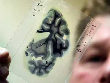 Un científico analiza una radiografía del cerebro humano. Un científico analiza una radiografía del cerebro humano.