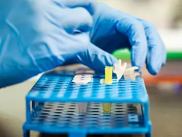 Fiebre, diarrea y dolor articular son los síntomas más comunes de la tularemia Fiebre, diarrea y dolor articular son los síntomas más comunes de la tularemia
