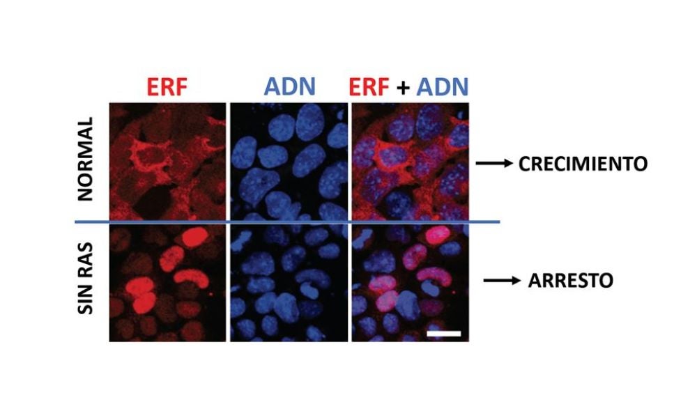 Las células tumorales podrían desarrollar resistencias frente a posibles inhibidores de Ras