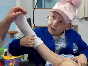 Una niña con cáncer de huesos podrá volver a bailar gracias una operación que sustituye su rodilla por su tobillo Una niña con cáncer de huesos podrá volver a bailar gracias una operación que sustituye su rodilla por su tobillo