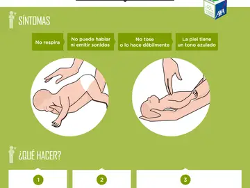 Maniobra Heimlich para menores de un año Maniobra Heimlich para menores de un año