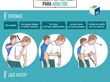 Maniobra de Heimlich en adultos Maniobra de Heimlich en adultos