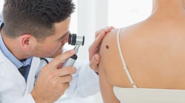 Prevención de melanoma Prevención de melanoma