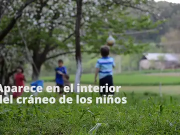 Proyecto para atacar con antirretrovirales los tumores ependimarios Proyecto para atacar con antirretrovirales los tumores ependimarios