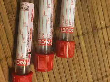 Análisis de sangre Análisis de sangre