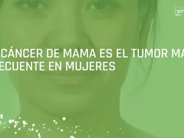 Investigadores del CNIO contra las células madre del cáncer de mama Investigadores del CNIO contra las células madre del cáncer de mama